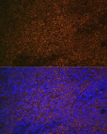 Anti-S100A12 Antibody (CAB5328)