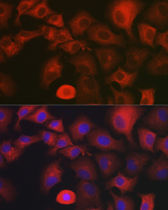 Anti-MYO10 Antibody (CAB12471)