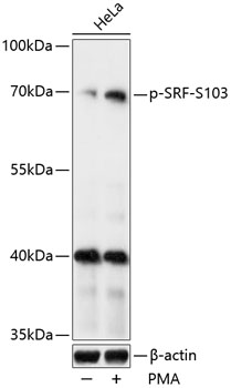 Anti-Phospho-SRF-S103 pAb (CABP0829)