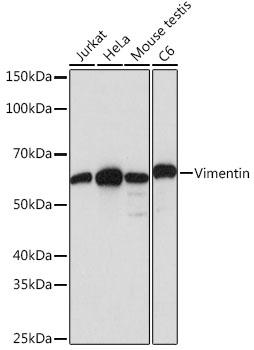 Anti-Vimentin Antibody [KO Validated] (CAB19607)