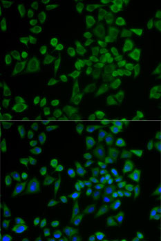 Anti-P2RY2 Antibody (CAB5779)