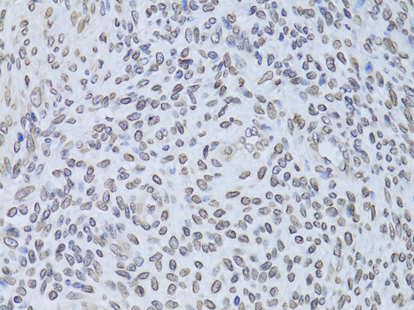 Anti-LMNB2 Antibody (CAB6483)