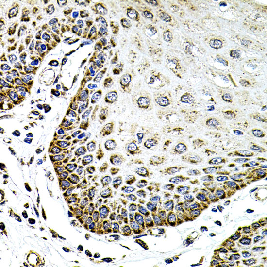 Anti-SDC2 Antibody (CAB1810)