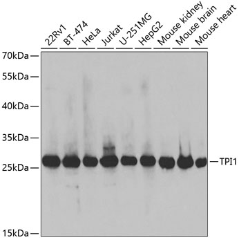 Anti-TPI1 Antibody (CAB2579)