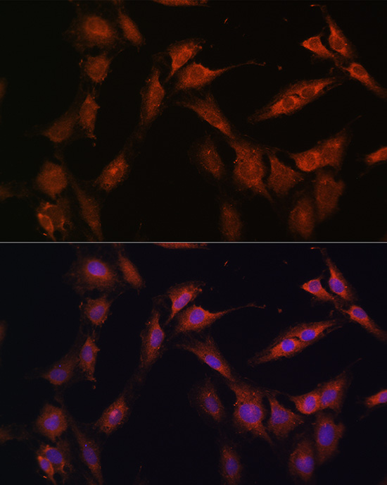 Anti-PFKFB2 Polyclonal Antibody (CAB9311)