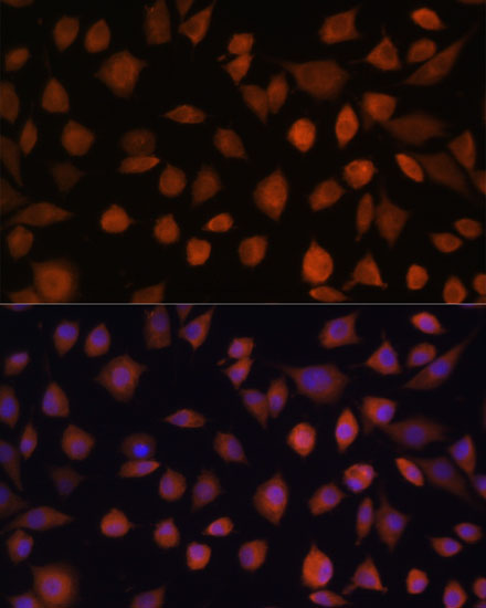 Anti-ARMC6 Antibody (CAB15931)