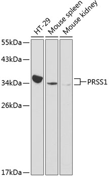 Anti-PRSS1 Antibody (CAB1242)