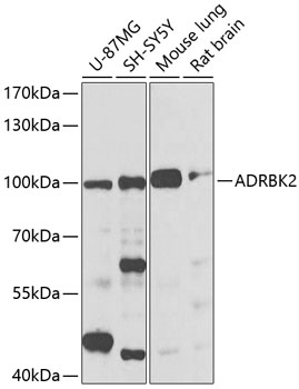 Anti-ADRBK2 Antibody (CAB2049)