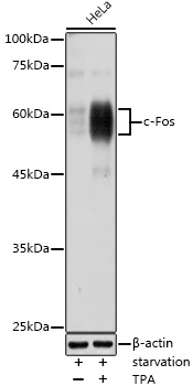 Anti-c-Fos Antibody (CAB16641)