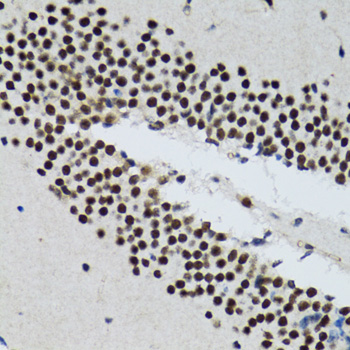 Anti-TXNL1 Antibody (CAB6322)