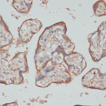 Anti-TES Antibody (CAB7094)