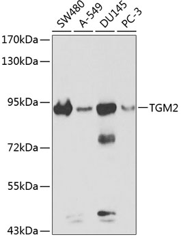 Anti-TGM2 Antibody (CAB0981)