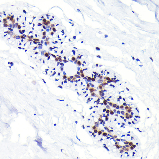 Anti-CDKN1B/p27KIP1 Antibody [KO Validated] (CAB19095)