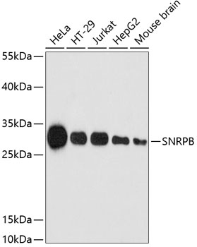 Anti-SNRPB Antibody (CAB2009)