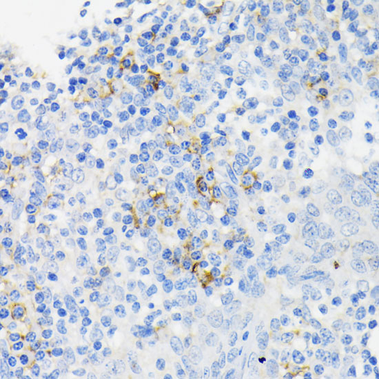 Anti-CAMP Antibody (CAB1640)