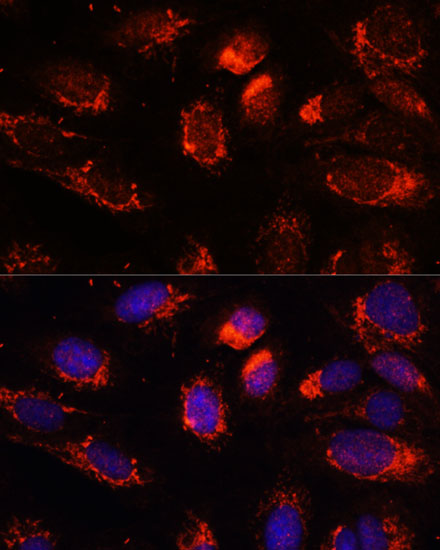 Anti-NUP210 Antibody (CAB16676)