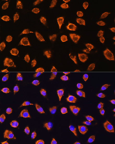 Anti-NOTCH4 Polyclonal Antibody (CAB8303)