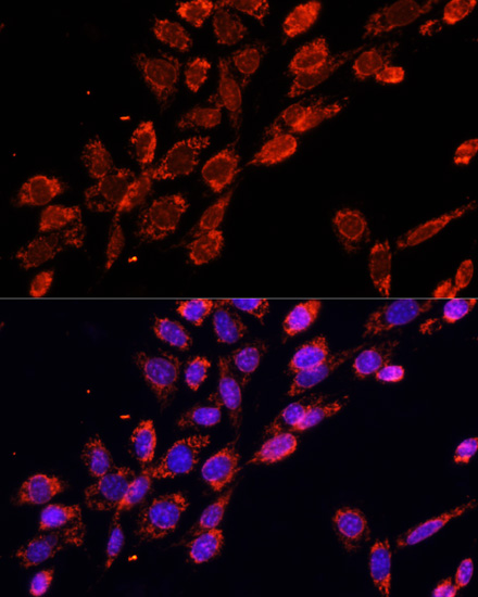 Anti-EIF4EBP1 Antibody (CAB16667)