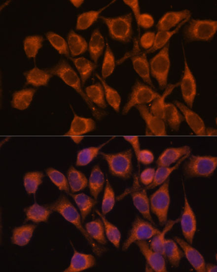 Anti-UBQLNL Antibody (CAB14451)