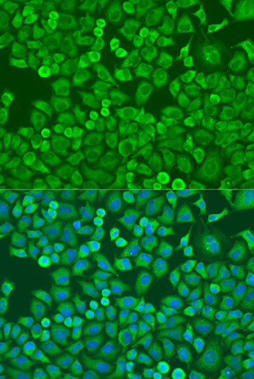 Anti-EIF4E Antibody (CAB6085)