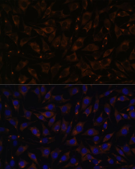 Anti-PLLP Antibody (CAB15834)