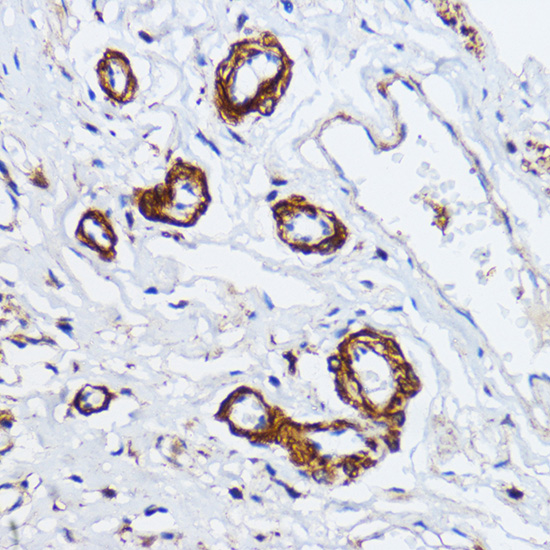 Anti-MYLK Polyclonal Antibody (CAB8041)
