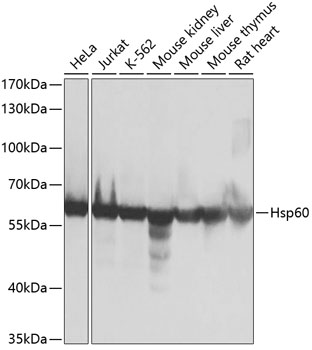 Anti-Hsp60 Antibody (CAB0969)