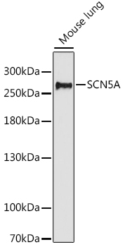 Anti-SCN5A Antibody (CAB16665)