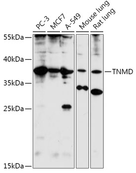 Anti-TNMD Antibody (CAB17753)