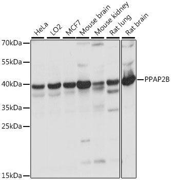 Anti-PPAP2B Antibody (CAB15743)