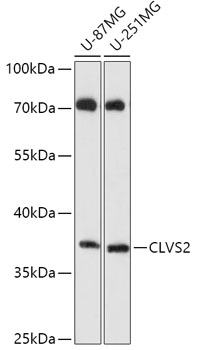 Anti-CLVS2 Antibody (CAB17826)