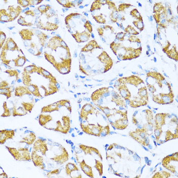 Anti-NDUFA5 Antibody [KO Validated] (CAB14751)