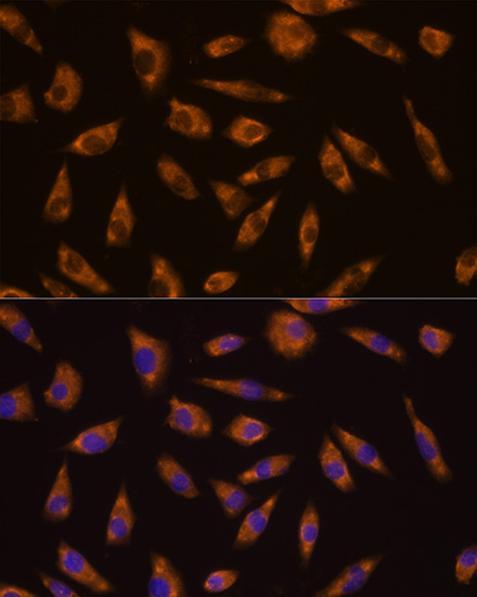 Anti-GLP1R Polyclonal Antibody (CAB8547)