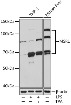 Anti-MSR1 Antibody (CAB1923)