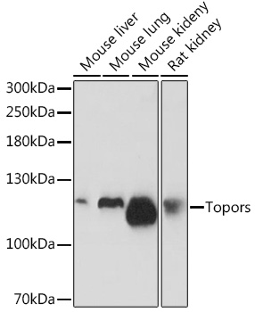 Anti-Topors Antibody (CAB18526)