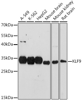 Anti-KLF9 Antibody (CAB7196)