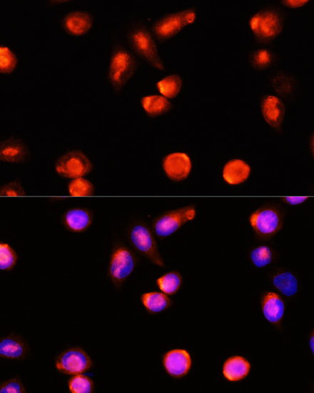 Anti-ABCA4 Antibody (CAB10556)