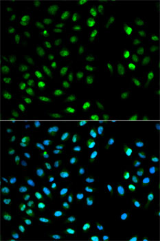 Anti-DTNBP1 Antibody (CAB1632)