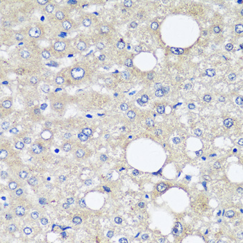 Anti-AFP Mouse Monoclonal Antibody (CAB11865)