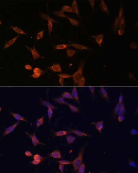 Anti-UMPS Antibody (CAB13251)