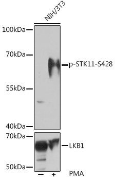 Anti-Phospho-STK11-S428 Antibody (CABP1108)