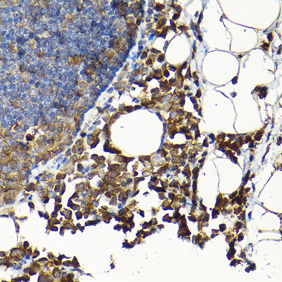 Anti-SCFD1 Polyclonal Antibody (CAB8835)