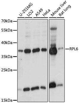 Anti-RPL6 Antibody (CAB15094)