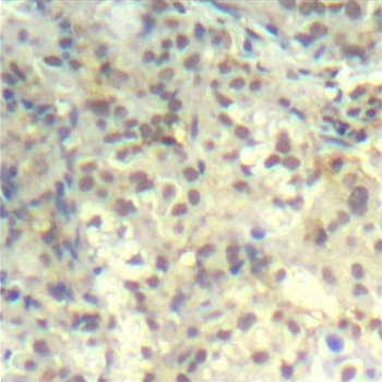 Anti-Phospho-Cofilin-1-Y139 Antibody (CABP0330)