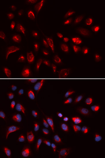 Anti-CHRM5 Antibody (CAB5367)