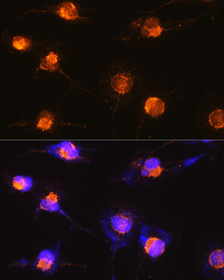 Anti-S100B Antibody (CAB0676)