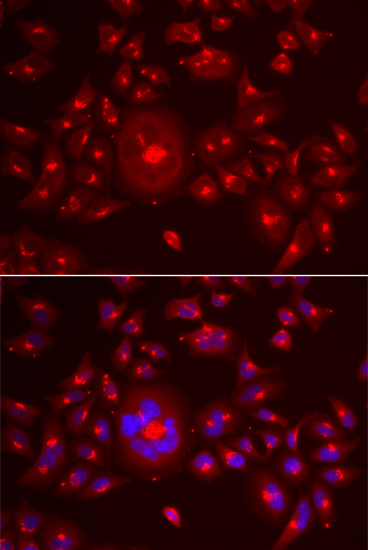 Anti-GORASP1 Antibody (CAB6609)