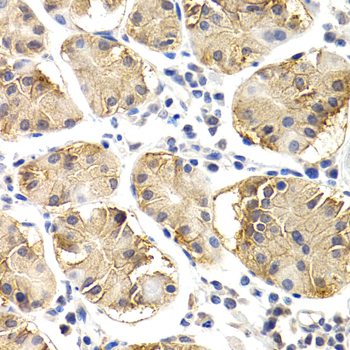 Anti-CHIT1 Antibody (CAB2015)