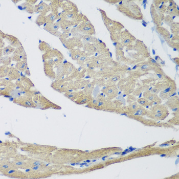 Anti-SMYD1 Antibody (CAB2340)