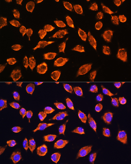 Anti-GRIN2A Antibody (CAB0924)